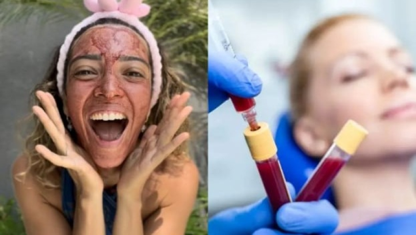 Դաշտանային դիմակ. Գեղեցկության նոր միտում, թե՞ վտանգավոր հիմարություն